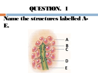 Name the structures labelled A-
E.
QUESTION. 1
 