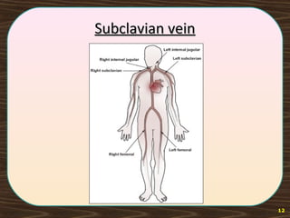 Subclavian veinSubclavian vein
12
 