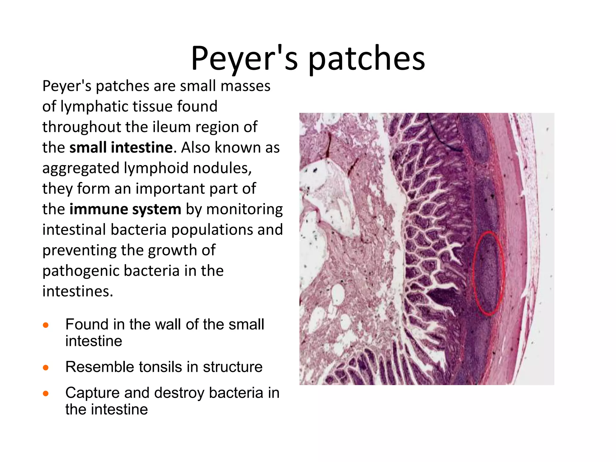 Peyer's patches
Peyer's patches are small masses
of lymphatic tissue found
throughout the ileum region of
the small intestine. Also known as
aggregated lymphoid nodules,
they form an important part of
the immune system by monitoring
intestinal bacteria populations and
preventing the growth of
pathogenic bacteria in the
intestines.
 Found in the wall of the small
intestine
 Resemble tonsils in structure
 Capture and destroy bacteria in
the intestine
 
