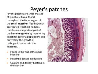 Peyer's patches
Peyer's patches are small masses
of lymphatic tissue found
throughout the ileum region of
the small intestine. Also known as
aggregated lymphoid nodules,
they form an important part of
the immune system by monitoring
intestinal bacteria populations and
preventing the growth of
pathogenic bacteria in the
intestines.
 Found in the wall of the small
intestine
 Resemble tonsils in structure
 Capture and destroy bacteria in
the intestine
 