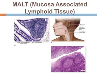 MALT (Mucosa Associated
Lymphoid Tissue)
27
 