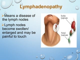 35
Lymphadenopathy
Means a disease of
the lymph nodes
Lymph nodes
become swollen/
enlarged and may be
painful to touch
 