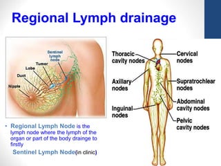 21
• Regional Lymph Node is the
lymph node where the lymph of the
organ or part of the body drainge to
firstly
Sentinel Lymph Node(in clinic)
Regional Lymph drainage
 