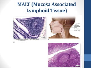 MALT (Mucosa Associated
Lymphoid Tissue)
27
 