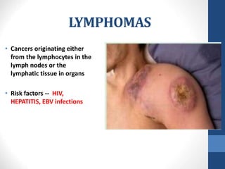 LYMPHOMAS
• Cancers originating either
from the lymphocytes in the
lymph nodes or the
lymphatic tissue in organs
• Risk factors -- HIV,
HEPATITIS, EBV infections
 