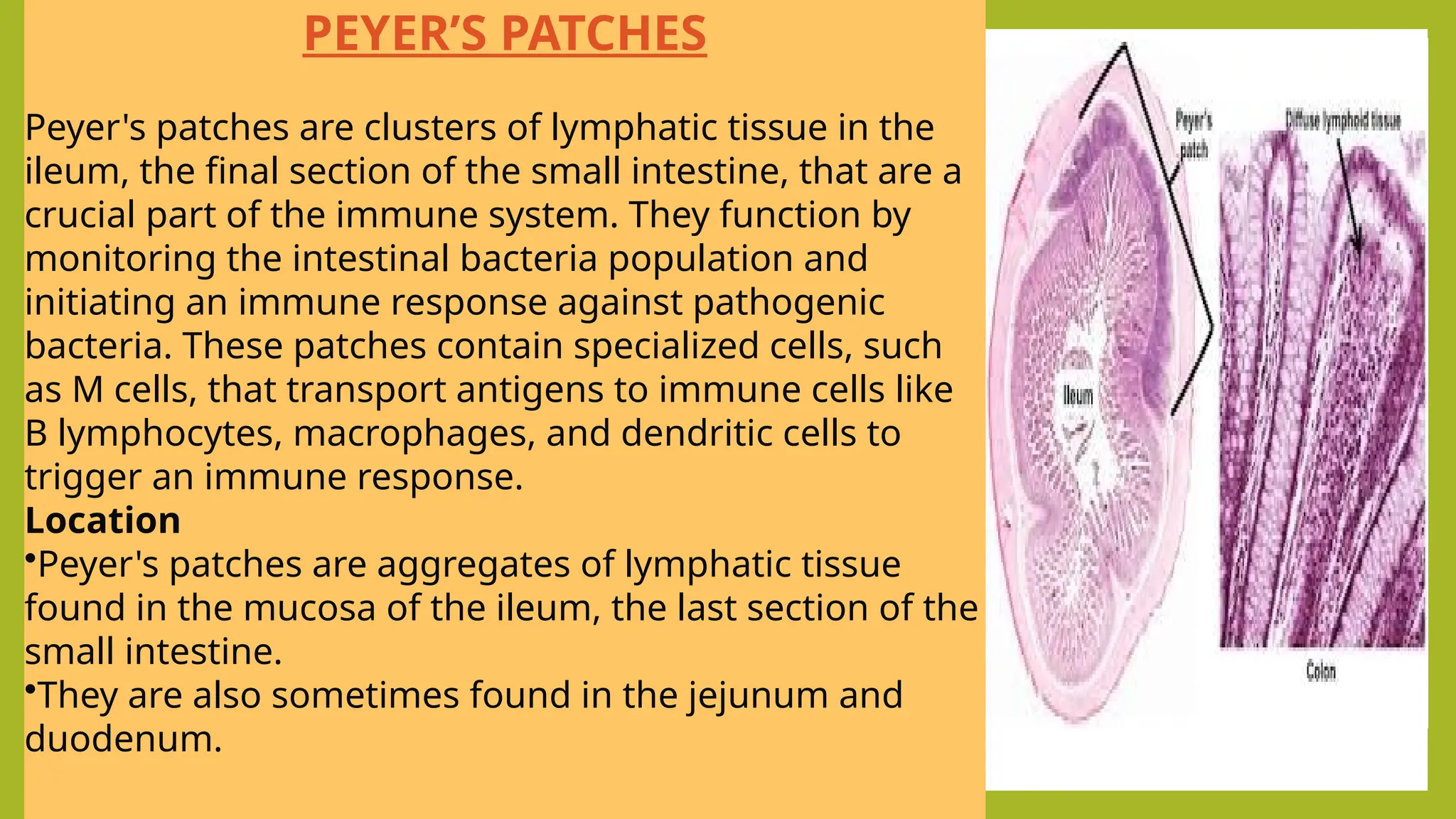 PAYER’S PATCHES
• Payer’s patches are aggregated
lymphoid follicles.
• These are situated in the inner lining
of the small intestine.
PEYER’S PATCHES
Peyer's patches are clusters of lymphatic tissue in the
ileum, the final section of the small intestine, that are a
crucial part of the immune system. They function by
monitoring the intestinal bacteria population and
initiating an immune response against pathogenic
bacteria. These patches contain specialized cells, such
as M cells, that transport antigens to immune cells like
B lymphocytes, macrophages, and dendritic cells to
trigger an immune response.
Location
•Peyer's patches are aggregates of lymphatic tissue
found in the mucosa of the ileum, the last section of the
small intestine.
•They are also sometimes found in the jejunum and
duodenum.
 