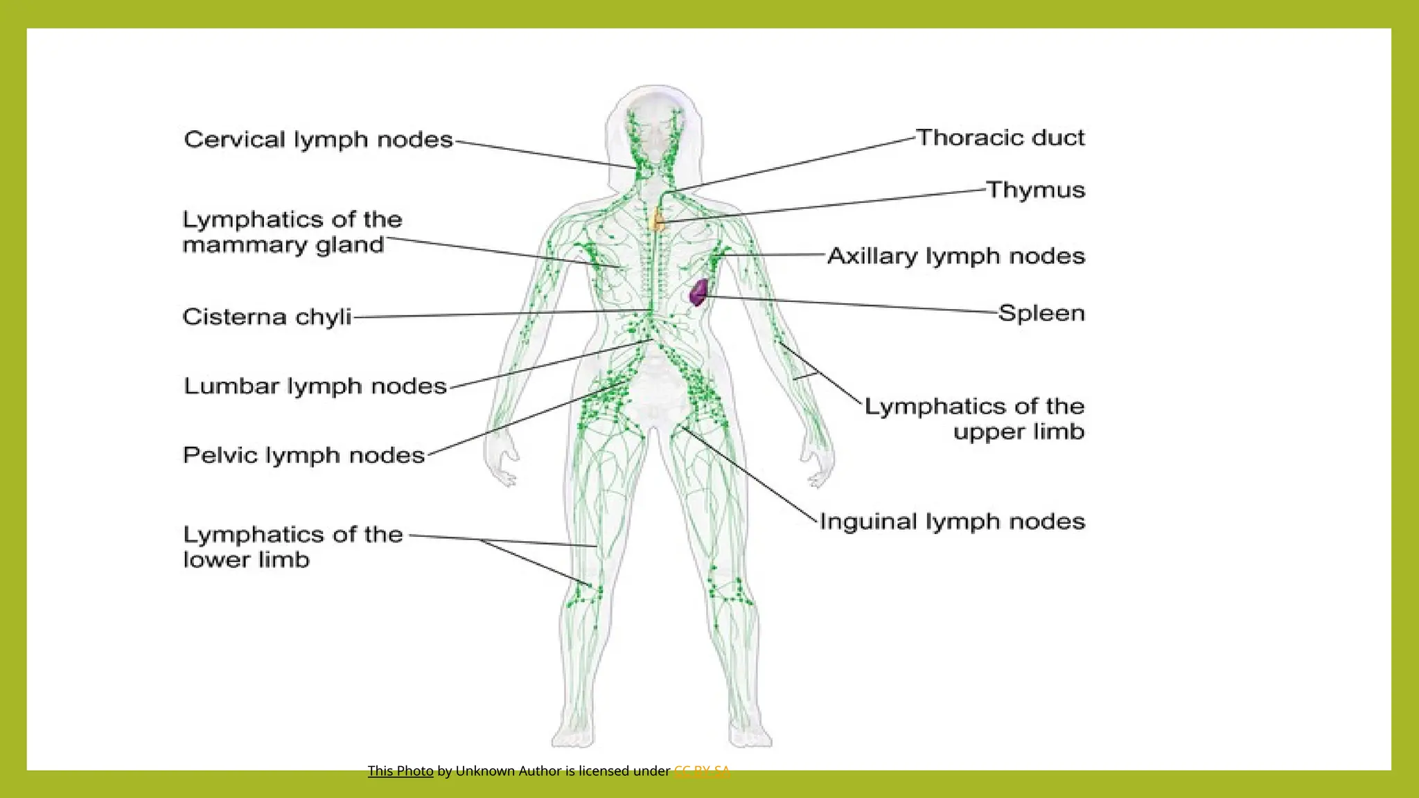 This Photo by Unknown Author is licensed under CC BY-SA
 
