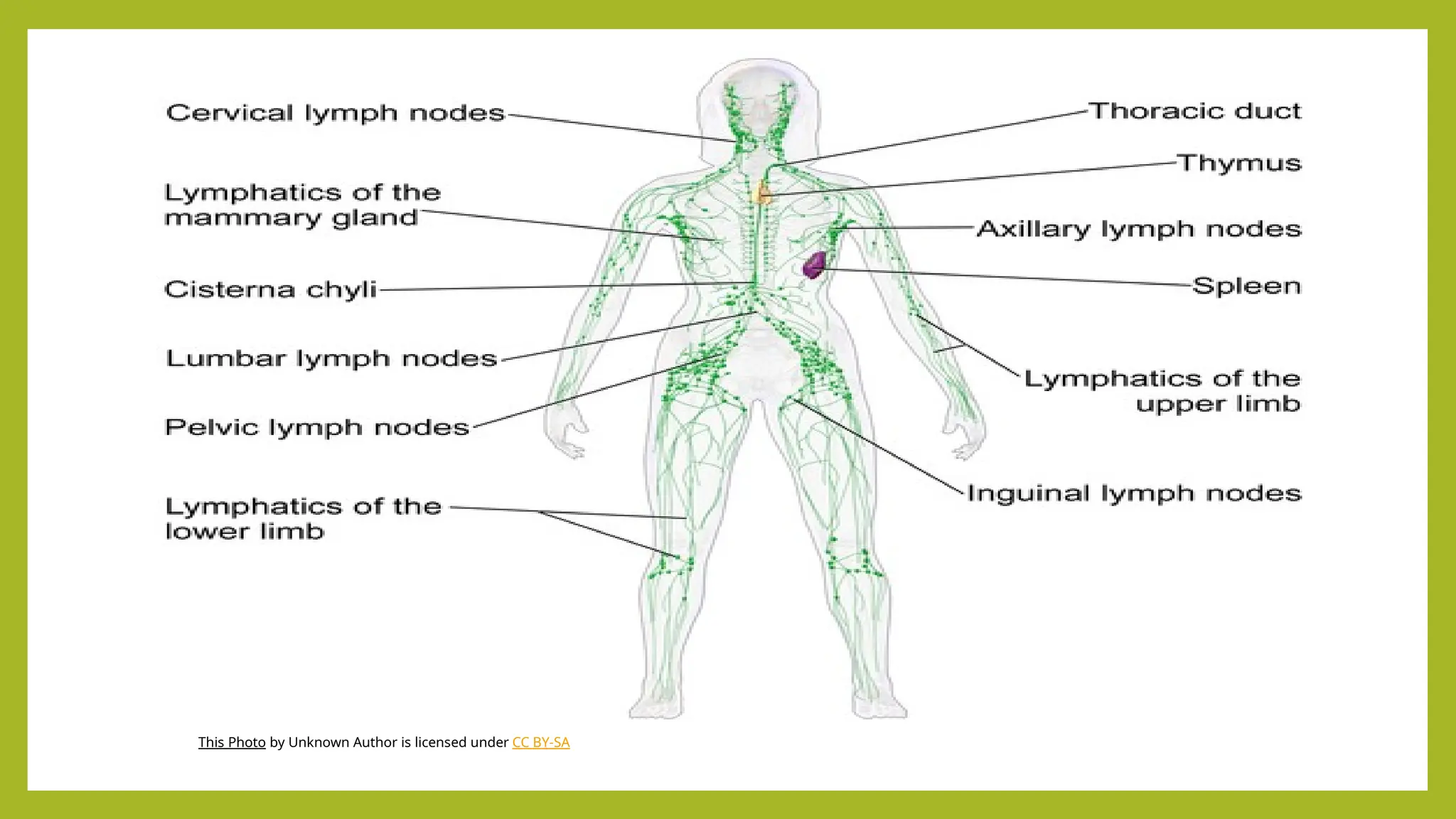 This Photo by Unknown Author is licensed under CC BY-SA
 