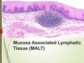 Mucosa Associated Lymphatic
Tissue (MALT)
 