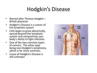 Hodgkin’s DiseaseNamed after Thomas Hodgkin – British physicianHodgkin’s Disease is a cancer of the lymphatic systemCells begin to grow abnormally, spread beyond the lymphatic system and compromises you body’s ability to fight infection.One of the two common types of cancers.  The other type being non-Hodgkin’s lymphoma, which is far more common.Cause of Hodgkin’s Disease is still unknown