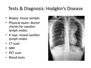 Tests & Diagnosis: Hodgkin’s DiseaseBiopsy: tissue samplePhysical exam: doctor checks for swollen lymph nodesX-rays: reveal swollen lymph nodesCT scanMRIPET scanBlood tests