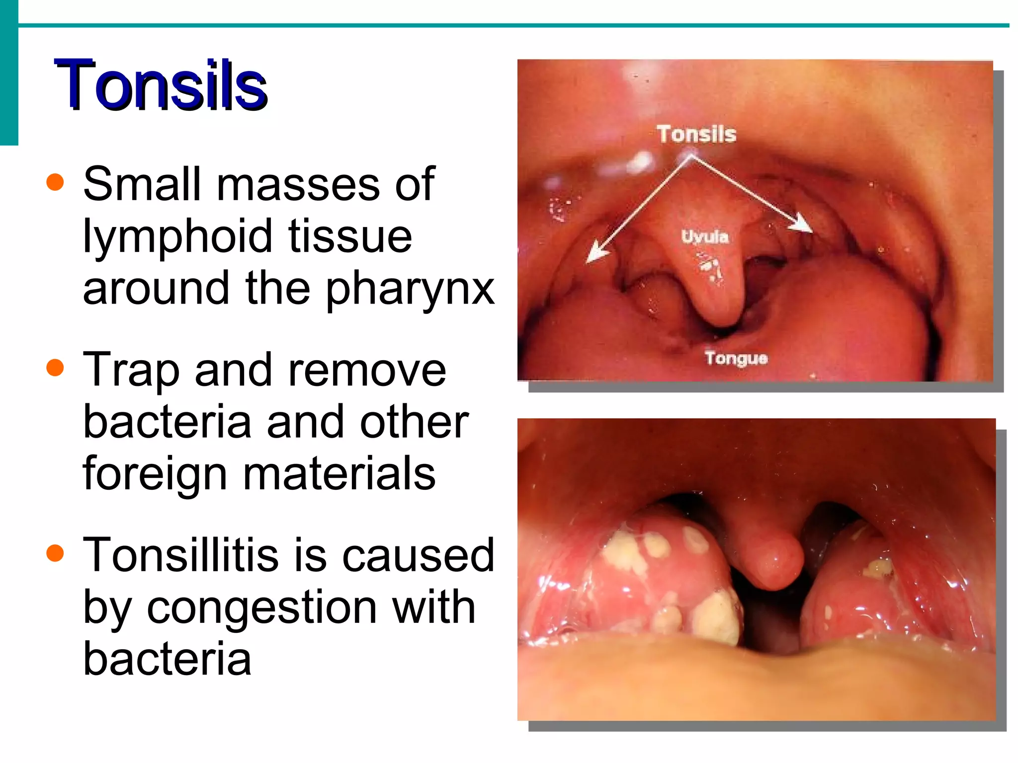 Tonsils
• Small masses of
  lymphoid tissue
  around the pharynx
• Trap and remove
  bacteria and other
  foreign materials
• Tonsillitis is caused
  by congestion with
  bacteria
 