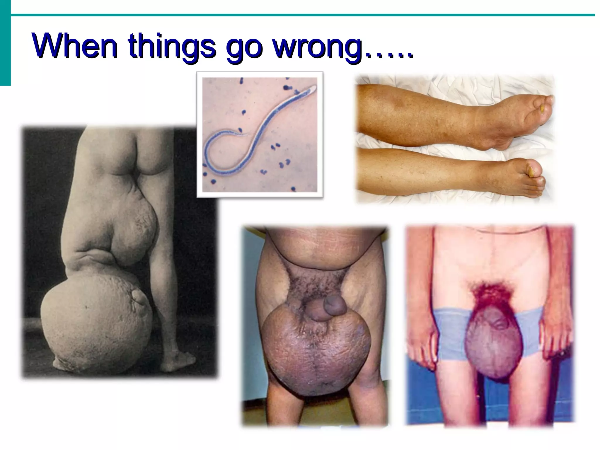 When things go wrong…..
 
