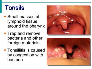 Tonsils
• Small masses of
  lymphoid tissue
  around the pharynx
• Trap and remove
  bacteria and other
  foreign materials
• Tonsillitis is caused
  by congestion with
  bacteria
 