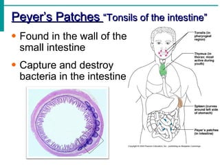 Peyer’s Patches “Tonsils of the intestine”
• Found in the wall of the
  small intestine
• Capture and destroy
  bacteria in the intestine
 