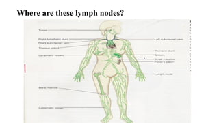 Where are these lymph nodes?
 