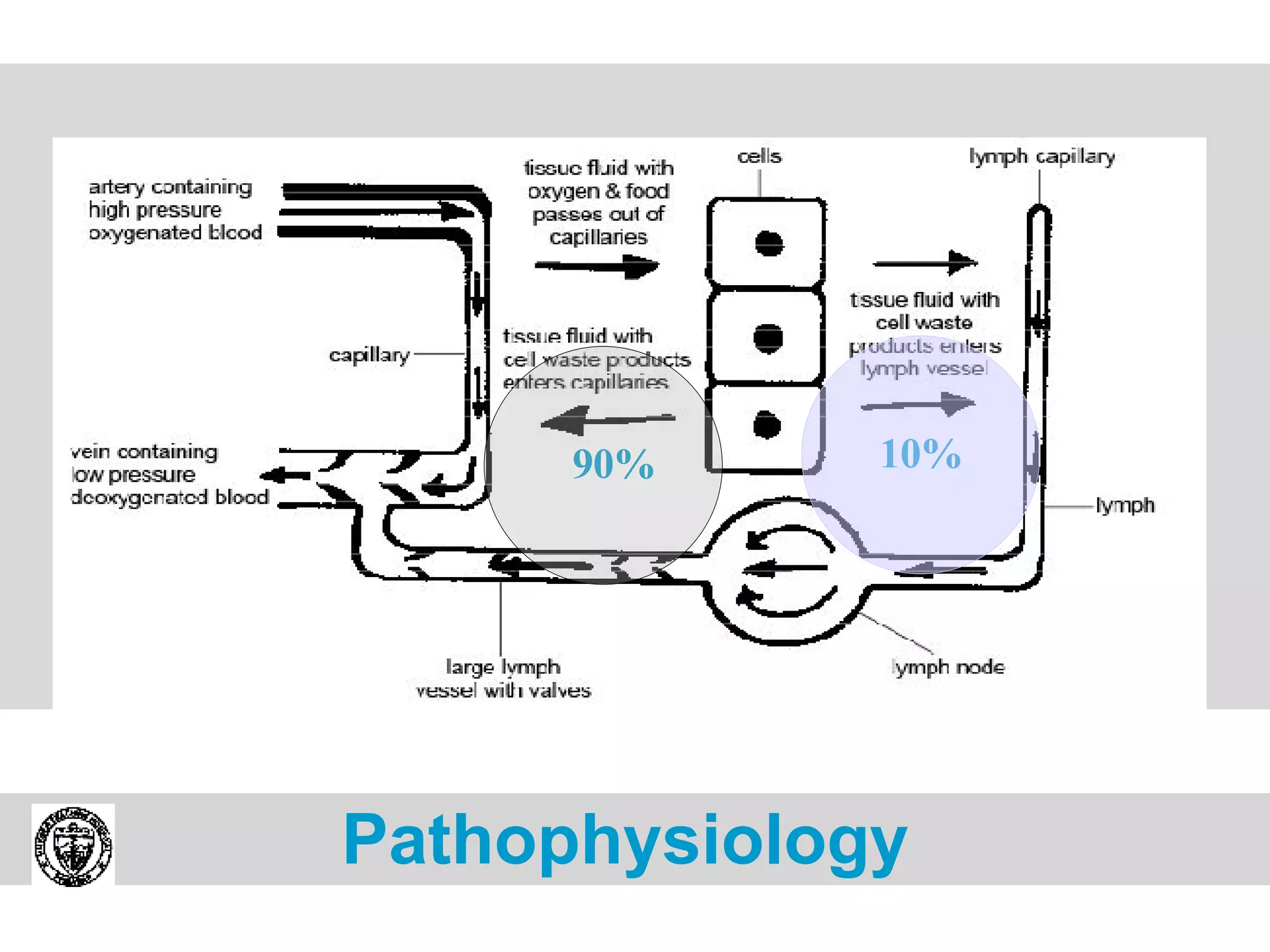 90% 10% Pathophysiology   