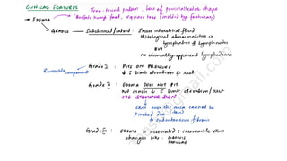 Lymphedema.pdf