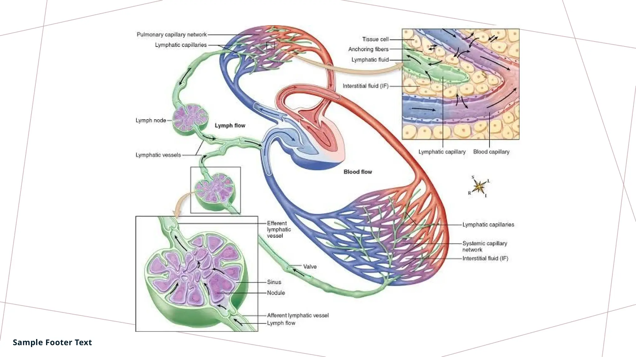 Lymphedema Lymphangitis Pathology Pptx