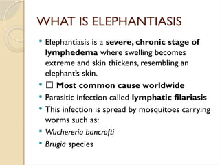 WHAT IS ELEPHANTIASIS
 Elephantiasis is a severe, chronic stage of
lymphedema where swelling becomes
extreme and skin thickens, resembling an
elephant’s skin.
 🔹 Most common cause worldwide
 Parasitic infection called lymphatic filariasis
 This infection is spread by mosquitoes carrying
worms such as:
 Wuchereria bancrofti
 Brugia species
 