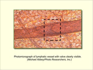 Photomicrograph of lymphatic vessel with valve clearly visible.
           (Michael Abbey/Photo Researchers, Inc.)
 