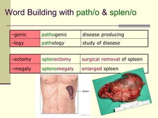 Word Building with path/o & splen/o

 –genic    pathogenic     disease producing
 –logy     pathology      study of disease


 –ectomy   splenectomy    surgical removal of spleen

 –megaly   splenomegaly   enlarged spleen
 