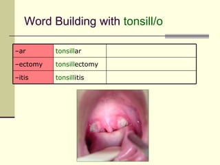 Word Building with tonsill/o

–ar       tonsillar

–ectomy   tonsillectomy

–itis     tonsillitis
 