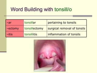Word Building with tonsill/o

–ar       tonsillar       pertaining to tonsils

–ectomy   tonsillectomy   surgical removal of tonsils

–itis     tonsillitis     inflammation of tonsils
 