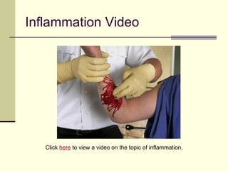 Inflammation Video




   Click here to view a video on the topic of inflammation.
 