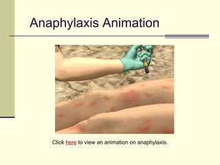 Anaphylaxis Animation




   Click here to view an animation on anaphylaxis.
 