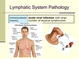Lymphatic System Pathology

mononucleosis acute viral infection with large
(mono)        number of atypical lymphocytes
 