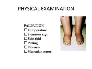 Pathology and Management of Lymphedema | PPT