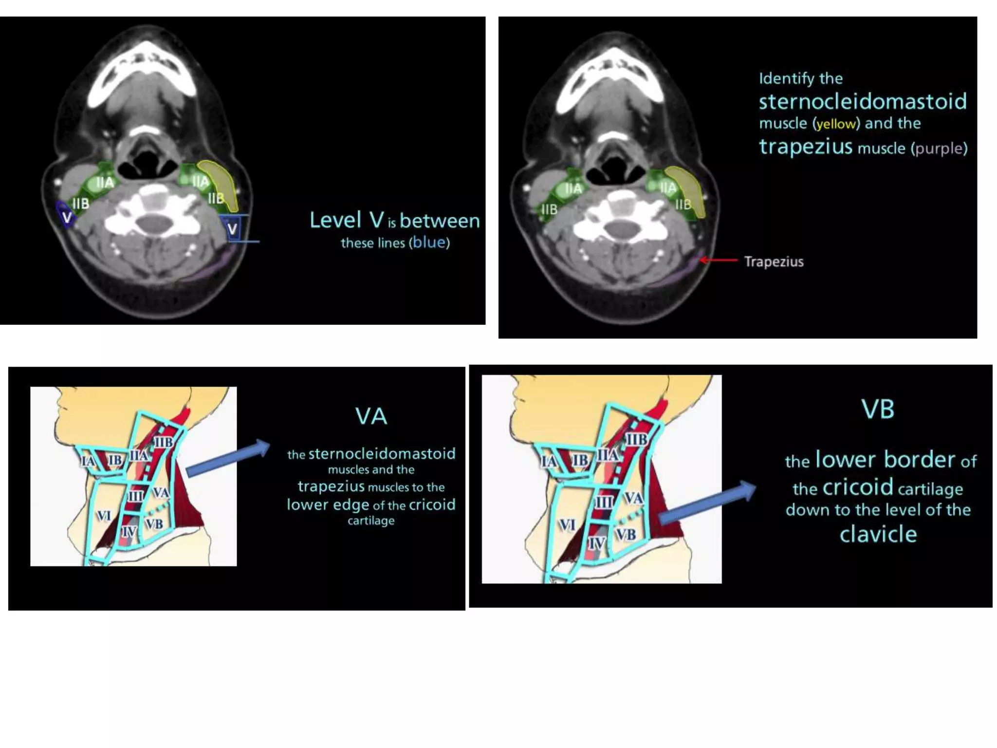 Lymph node anatomy for pet ct | PPTX