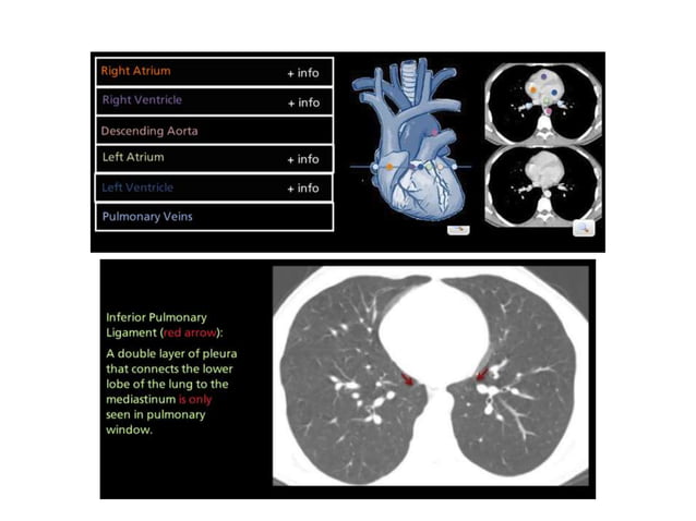 Lymph node anatomy for pet ct | PPT