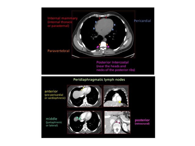 Lymph node anatomy for pet ct | PPT