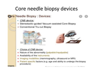 Core needle biopsy devices
 