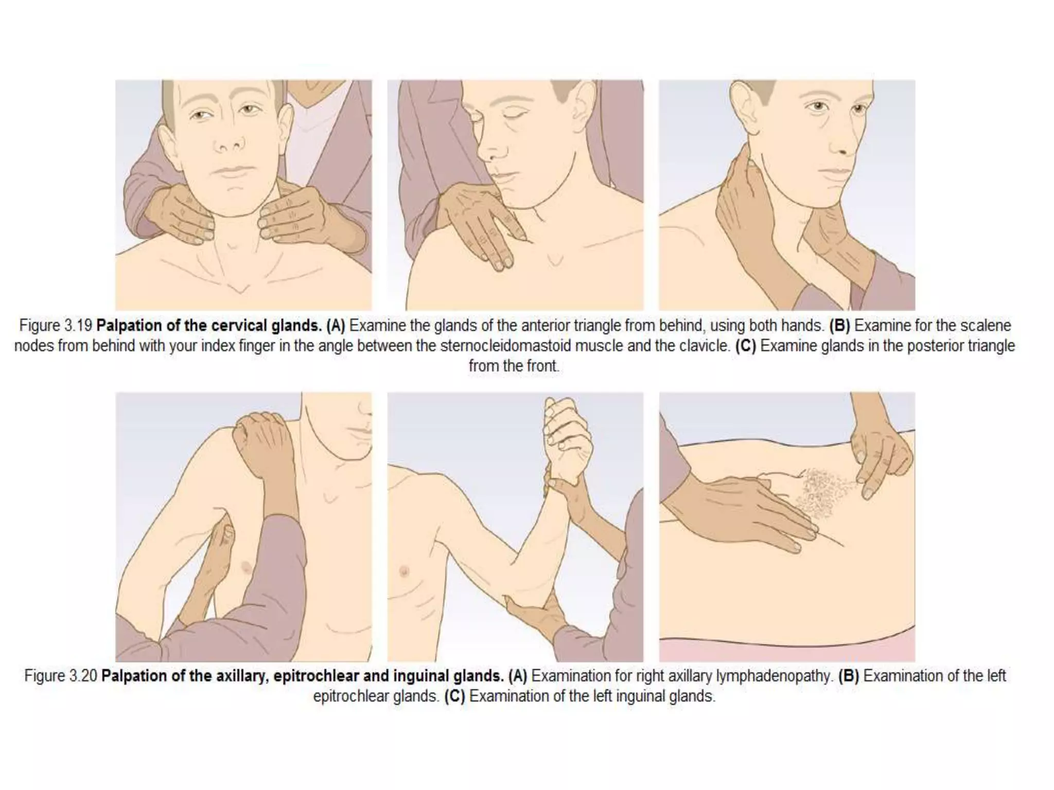 Lymph node, Lump, & Ulcer Examination.pptx