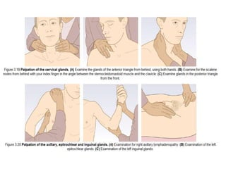 Lymph node, Lump, & Ulcer Examination.pptx