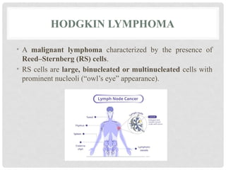 HODGKIN LYMPHOMA
• A malignant lymphoma characterized by the presence of
Reed–Sternberg (RS) cells.
• RS cells are large, binucleated or multinucleated cells with
prominent nucleoli (“owl’s eye” appearance).
 