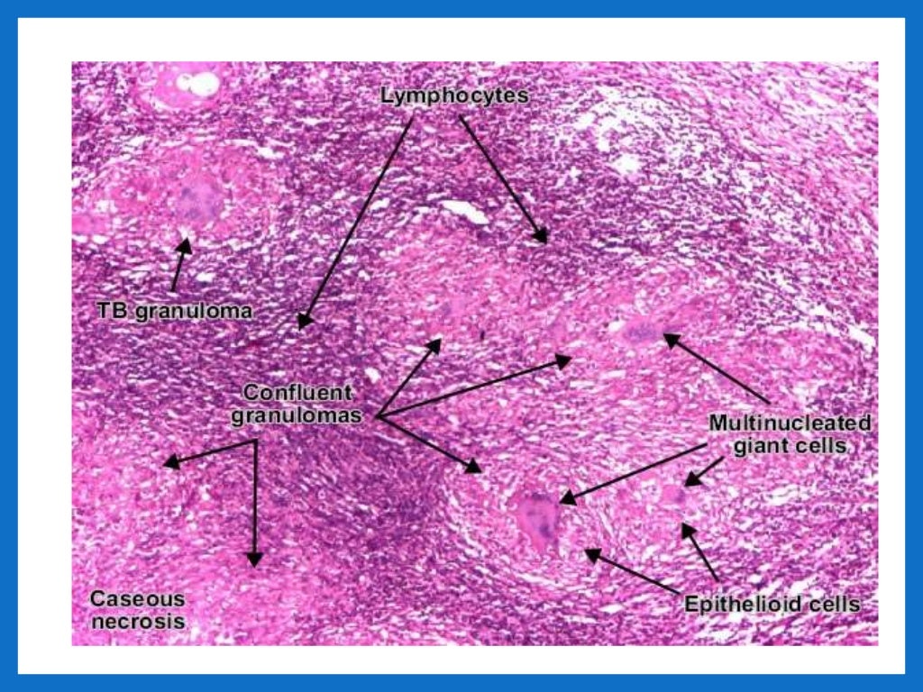 Histology and pathology of lymph nodes