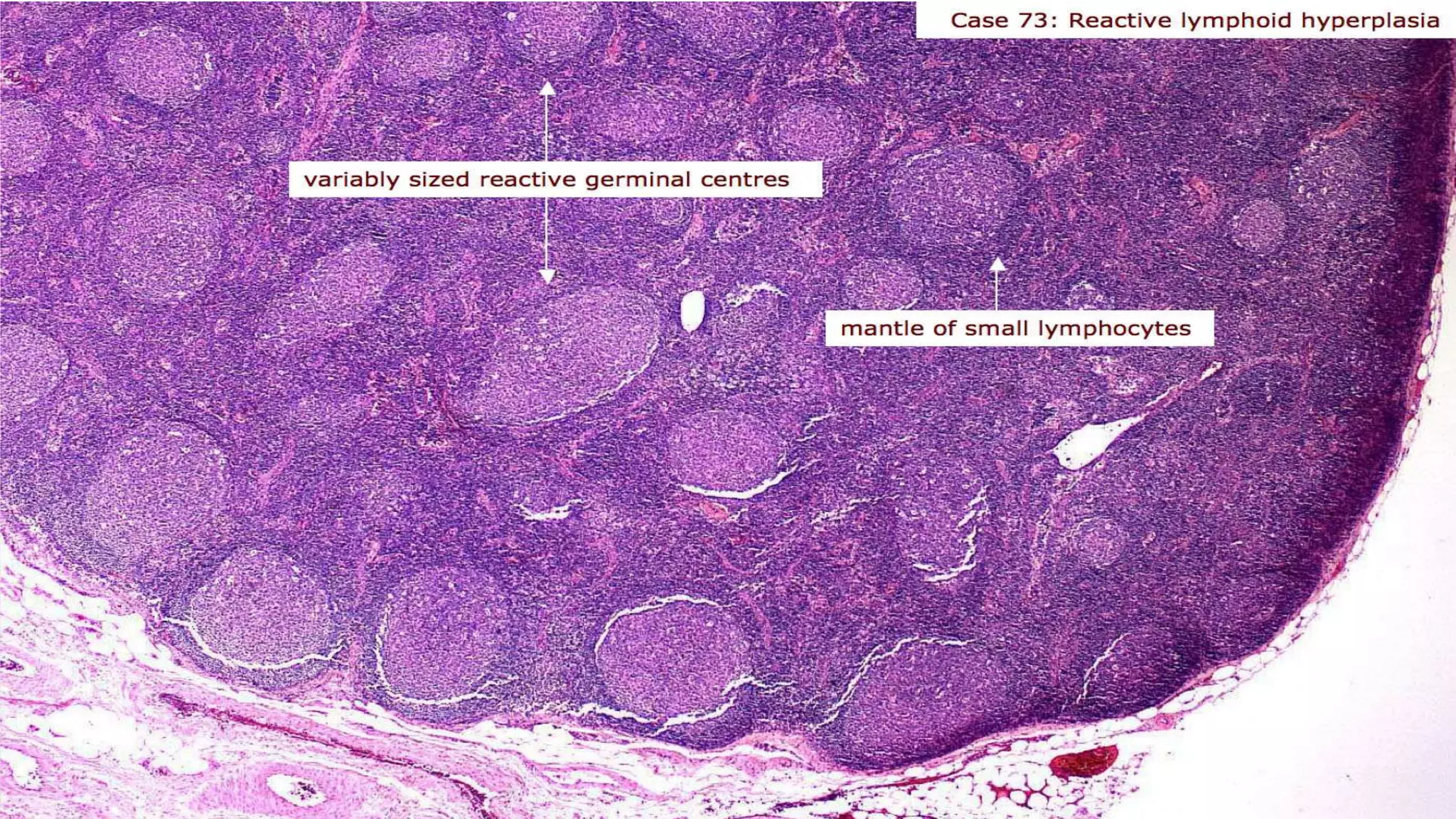 Lymph Node - A Histologcal Overview | PPTX