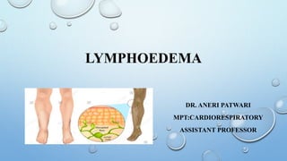 LYMPHOEDEMA
DR. ANERI PATWARI
MPT:CARDIORESPIRATORY
ASSISTANT PROFESSOR
 