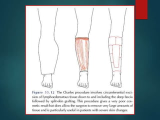 lymphoedema basics and management plan .ppt