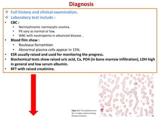 Diagnosis
 Full history and clinical examination.
 Laboratory test include :
• CBC :
• Normochromic normocytic anemia.
• Plt vary as normal or low.
• WBC with neutropenia in advanced disease. .
• Blood film show :
• Rouleaux fornamtion
• Abnormal plasma cells appear in 15%.
• ESR usually raised and used for monitoring the progress.
• Biochemical tests show raised uric acid, Ca, PO4 (in bone marrow infiltration), LDH high
in general and low serum albumin.
• RFT with raised creatinine.
 