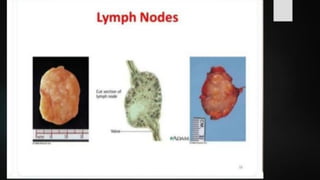 LYMPHOID TIASUES.pdf