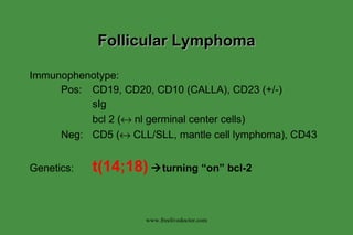 Lymphoma | PPT