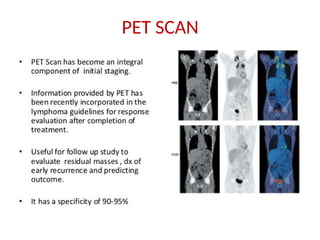 17
PET SCAN
 