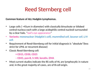23
Reed Sternberg cell
Common feature of ALL Hodgkin Lymphomas.
• Large cells ( >45um in diameter) with classically binucleate or bilobed
central nucleus each with a large acidophilic central nucleoli surrounded
by a clear halo. “owl’s eye appearance”
• Variants: mononuclear (Hodgkin’s cell), mummified cell, lacunar cell, L/H
cell.
• Requirement of Reed-Sternberg cell for initial diagnosis is “absolute”(less
strict for LPHL or recurrent disease)
• Classic Reed-Sternberg cell:
+ CD15, CD30, CD25
– CD45, pan-B, S-100, keratin, EMA
• Most current studies indicate the RS cells of HL are lymphocytic in nature
and, in the great majority of cases, are of B-cell origin.
 