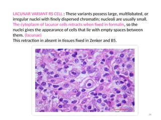 39
LACUNAR VARIANT RS CELL : These variants possess large, multilobated, or
irregular nuclei with finely dispersed chromatin; nucleoli are usually small.
The cytoplasm of lacunar cells retracts when fixed in formalin, so the
nuclei gives the appearance of cells that lie with empty spaces between
them. (lacunae)
This retraction in absent in tissues fixed in Zenker and B5.
 