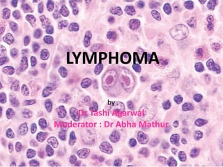 LYMPHOMA
by
Dr Tashi Agarwal
Moderator : Dr Abha Mathur
1
 